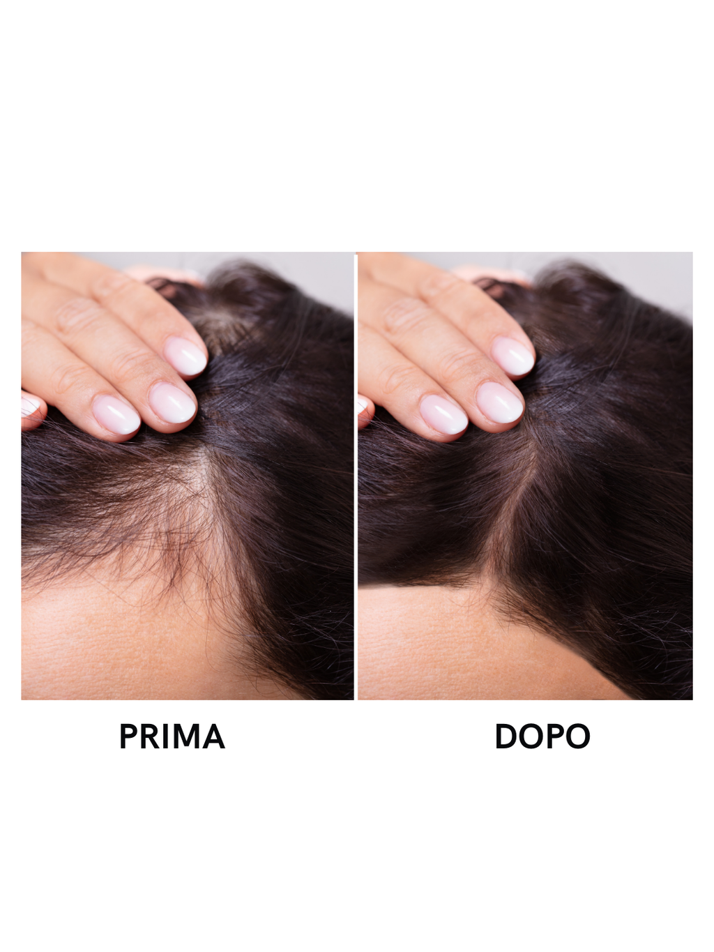 Integratore per capelli