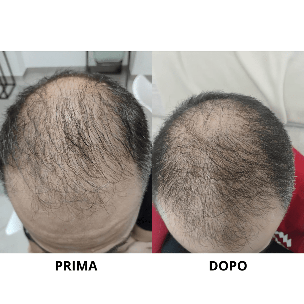 Integratore - Difendi e rafforza i tuoi capelli - EmilianoQuintino shop